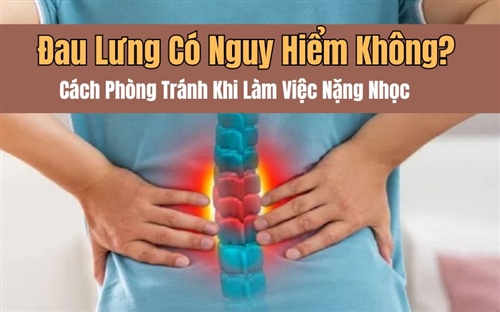 Đau Lưng Có Nguy Hiểm Không? Cách Phòng Tránh Khi Làm Việc Nặng Nhọc