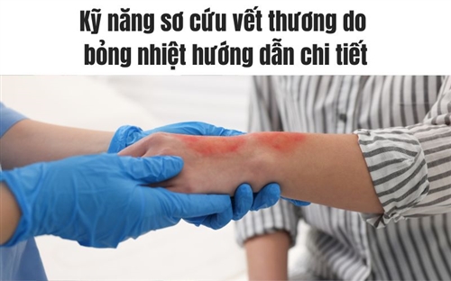 Kỹ năng sơ cứu vết thương do bỏng nhiệt hướng dẫn chi tiết